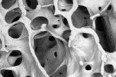 Normal Bone
