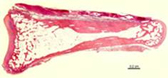 Adult human bone sequence