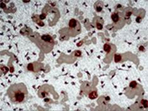 Human osteoclast resorption trails