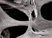 Normal to osteoporotic SEM sequence 1 RGB