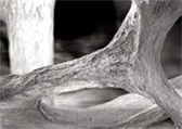 Normal to osteoporotic SEM sequence 2 RGB