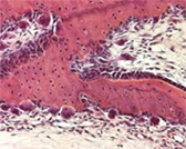 Tooth eruption & bone cells