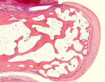Image: Bone, microscopic structure