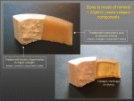 Image: Bone composition