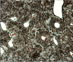 cortical bone