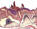 Image: Tooth eruption