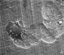 Image: Osteoclast