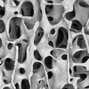 Image: Normal bone