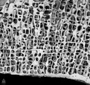 Image: Normal bone