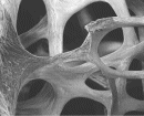 Image: Osteoporotic bone